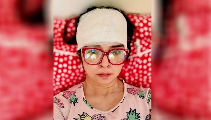দুর্ঘটনায় গুরুতর আহত অভিনেত্রী, মাথায় ১৫ সেলাই
